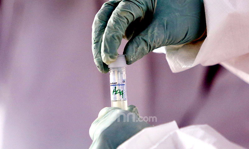 Uji Coba Vaksin Corona kepada 10.260 Orang, Semoga Ada Kabar Baik – JPNN.com