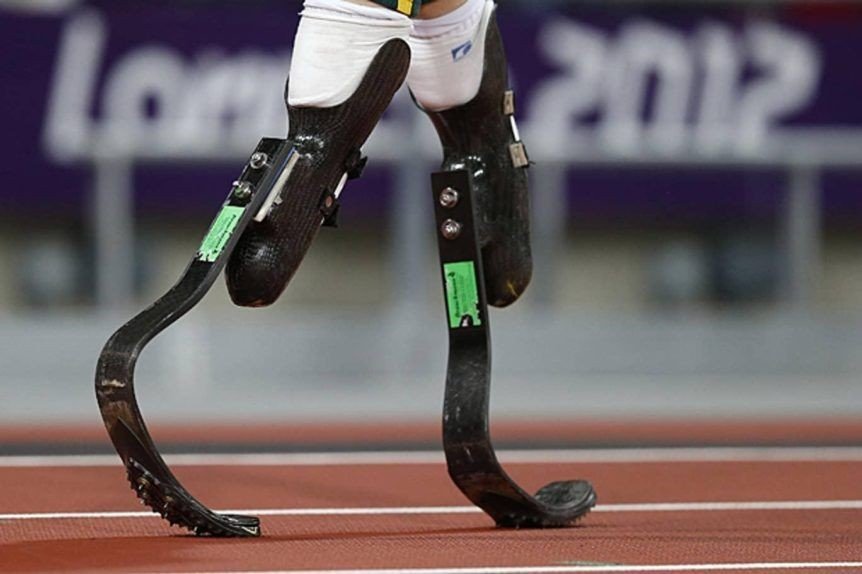 prosthesis-8e06848e7b26622a27193f099ff306b8
