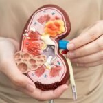 Gejala Kanker Ginjal yang Sering Terlewat dan Perlu Diwaspadai