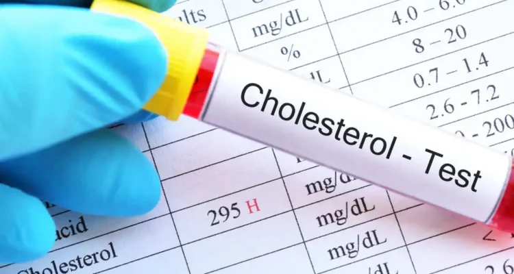 Penyebab Kolesterol Tinggi dan Gejalanya, Ancaman Sunyi yang Sering Terlambat Disadari